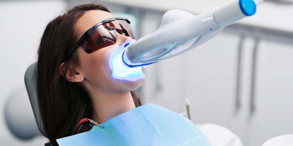 オフィスホワイトニングをしている様子